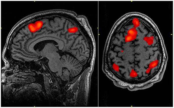 Brain Imaging